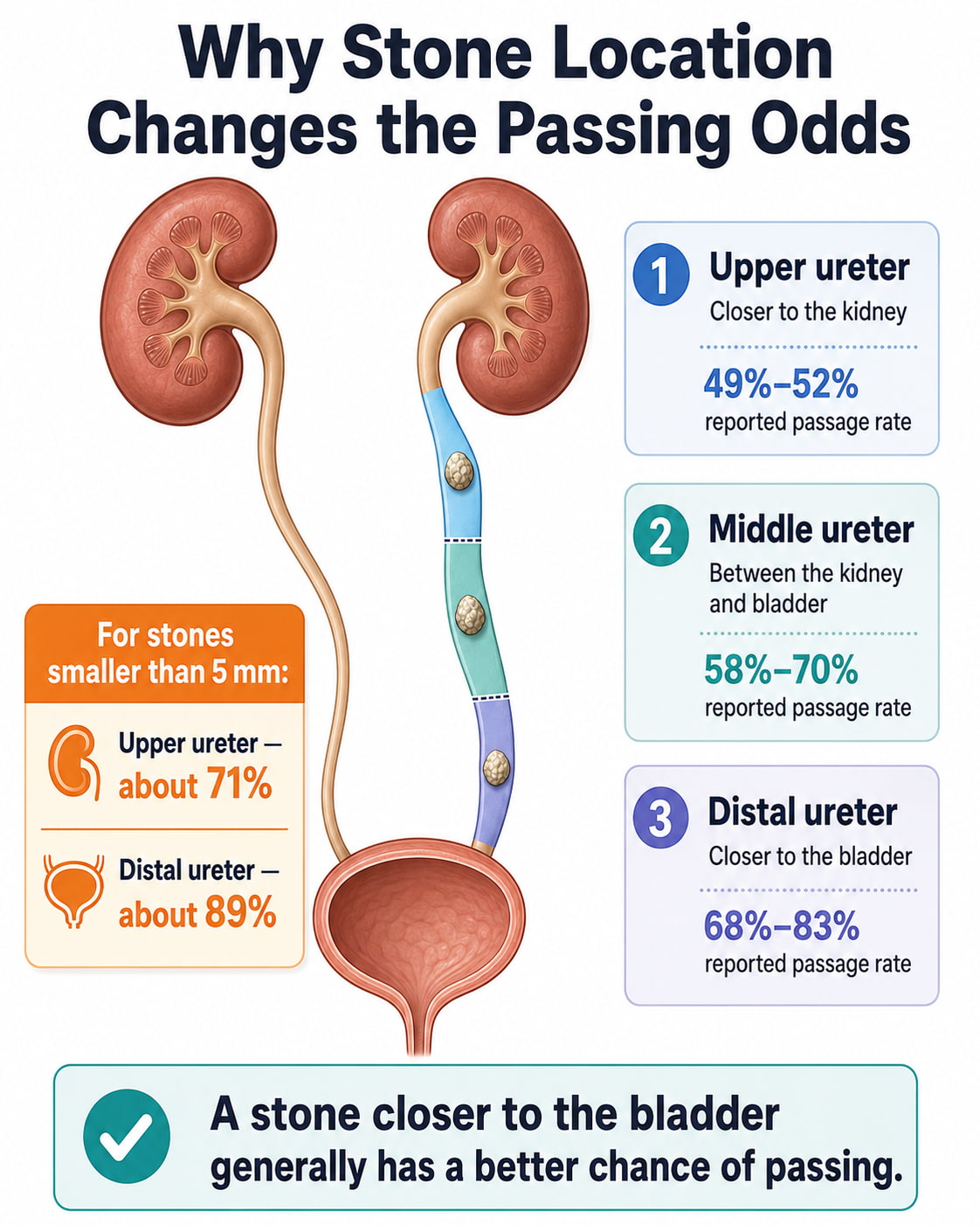 Why Stone Location Changes the Passing Odds
