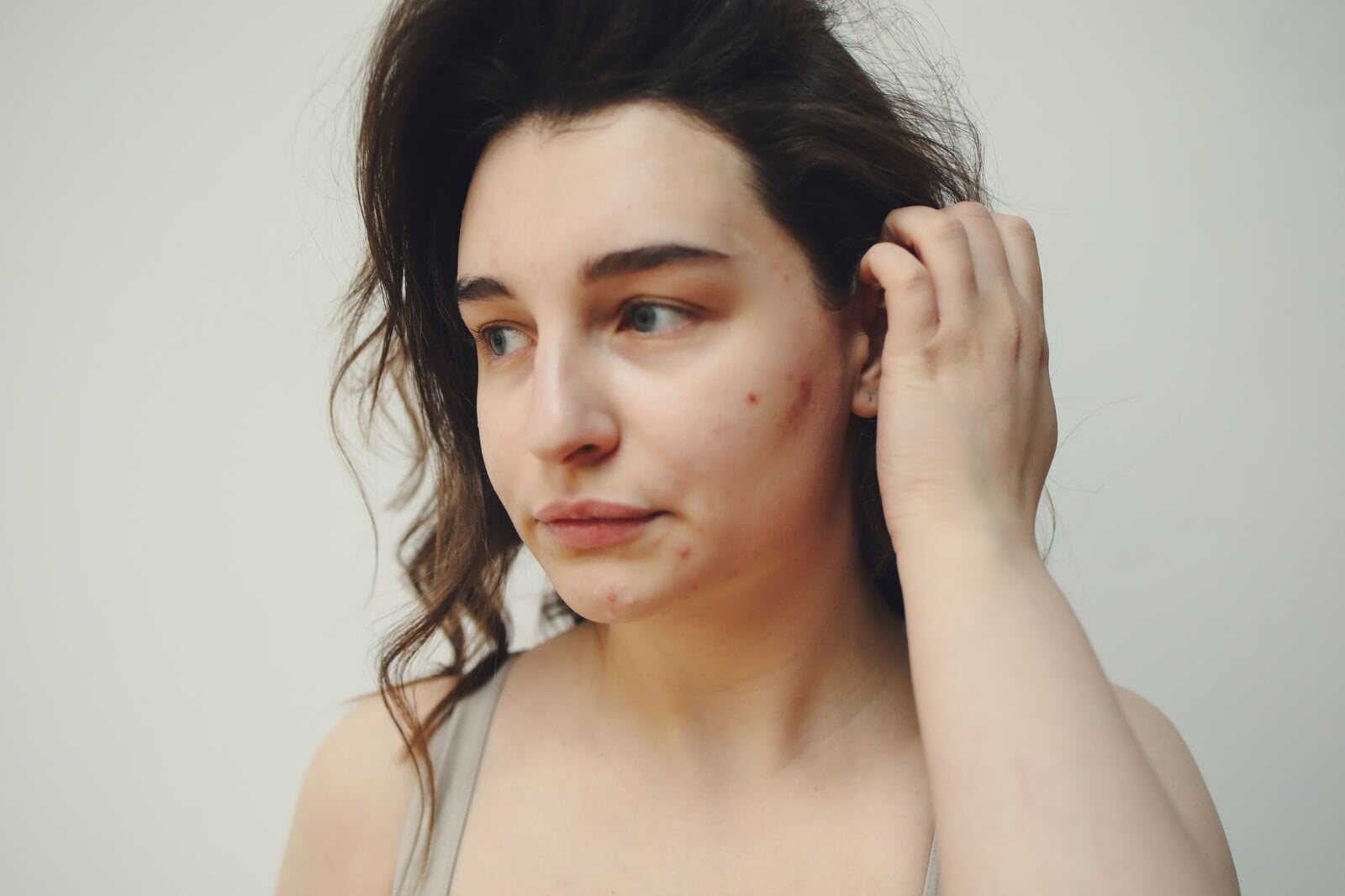 How to Pop a Pimple Safely: Steps, Risks & Aftercare